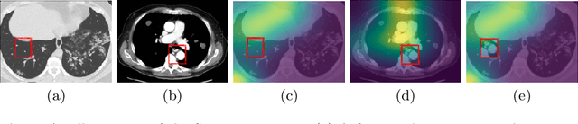 Figure 1 for Explainability Guided Multi-Site COVID-19 CT Classification