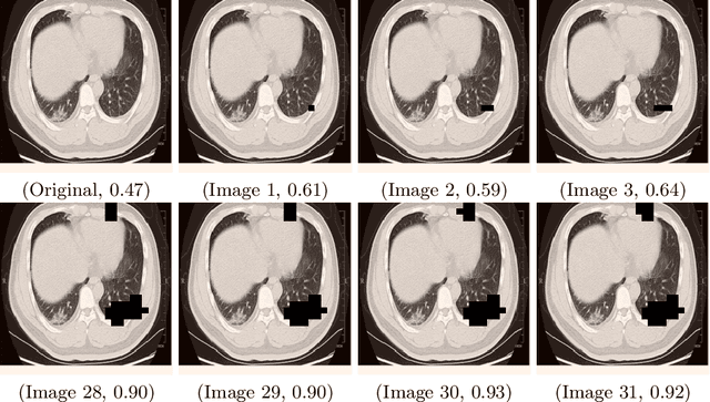 Figure 3 for Explainability Guided Multi-Site COVID-19 CT Classification