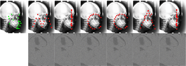 Figure 1 for Miss the Point: Targeted Adversarial Attack on Multiple Landmark Detection