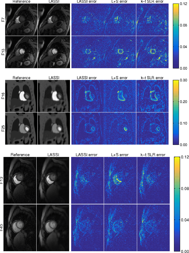 Figure 3 for Low-rank and Adaptive Sparse Signal (LASSI) Models for Highly Accelerated Dynamic Imaging