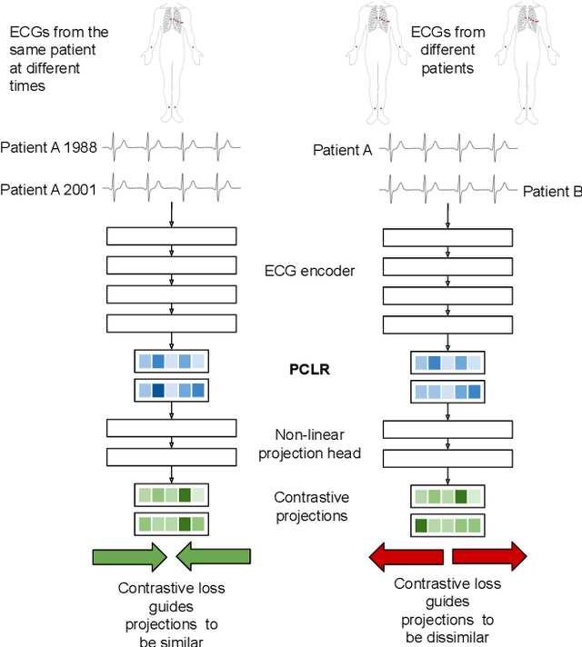 Figure 3 for Patient Contrastive Learning: a Performant, Expressive, and Practical Approach to ECG Modeling