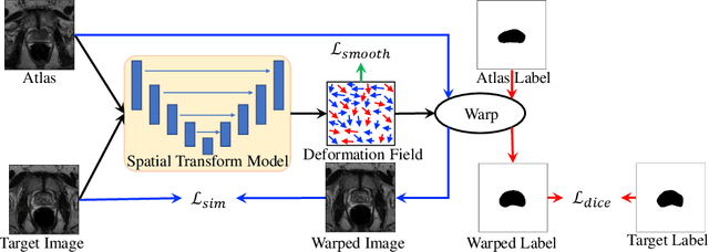 Figure 1 for OASIS: One-pass aligned Atlas Set for Image Segmentation