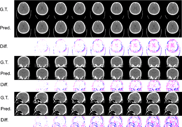 Figure 3 for Aging prediction using deep generative model toward the development of preventive medicine