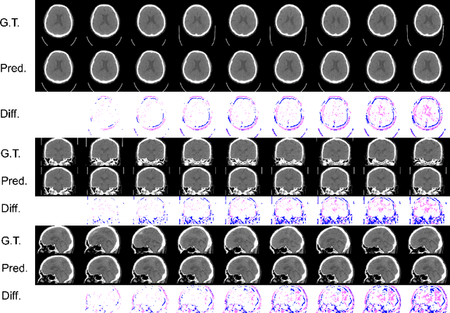 Figure 4 for Aging prediction using deep generative model toward the development of preventive medicine
