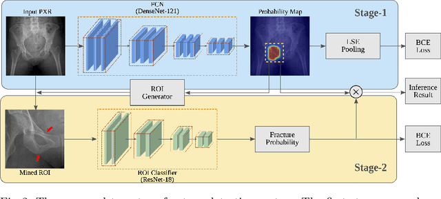 Figure 3 for Weakly Supervised Universal Fracture Detection in Pelvic X-rays