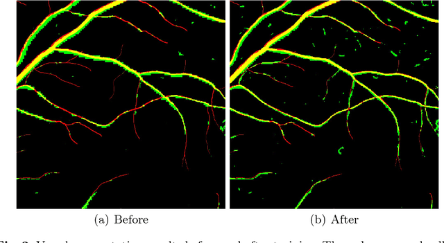 Figure 3 for Frangi-Net: A Neural Network Approach to Vessel Segmentation
