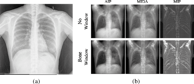 Figure 1 for Neural Radiance Projection