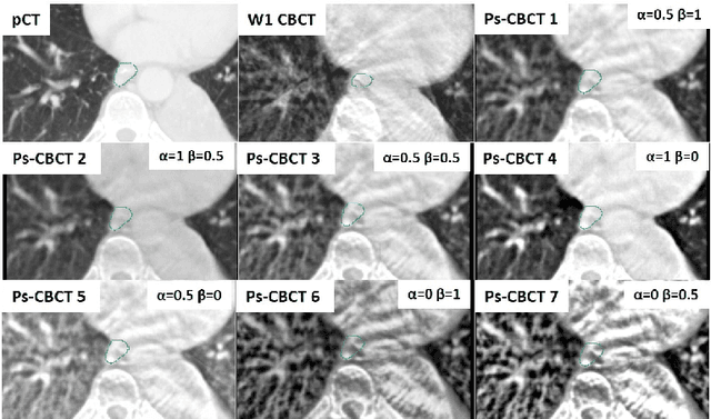 Figure 4 for Generalizable Cone Beam CT Esophagus Segmentation Using In Silico Data Augmentation