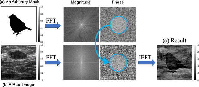 Figure 1 for An Ultra-Fast Method for Simulation of Realistic Ultrasound Images