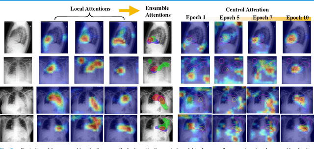 Figure 3 for Federated Learning with Privacy-Preserving Ensemble Attention Distillation