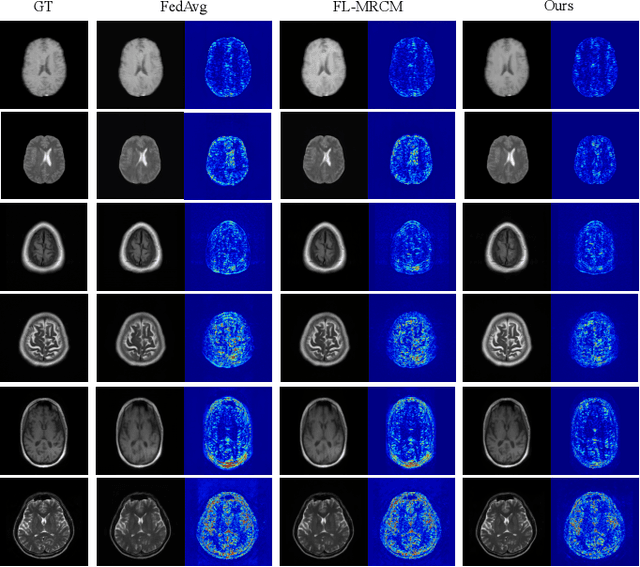 Figure 4 for Federated Learning with Privacy-Preserving Ensemble Attention Distillation