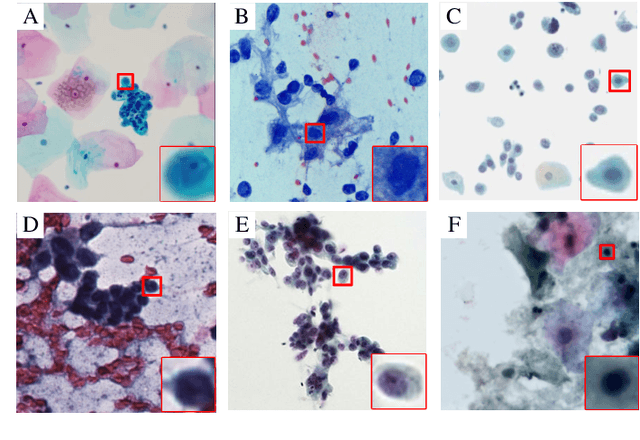 Figure 3 for Deep Learning for Computational Cytology: A Survey
