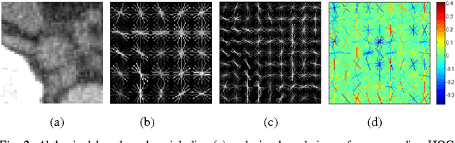 Figure 3 for 2D View Aggregation for Lymph Node Detection Using a Shallow Hierarchy of Linear Classifiers