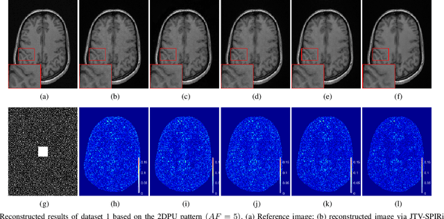 Figure 3 for Iterative Self-consistent Parallel Magnetic Resonance Imaging Reconstruction based on Nonlocal Low-Rank Regularization