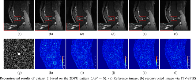 Figure 4 for Iterative Self-consistent Parallel Magnetic Resonance Imaging Reconstruction based on Nonlocal Low-Rank Regularization