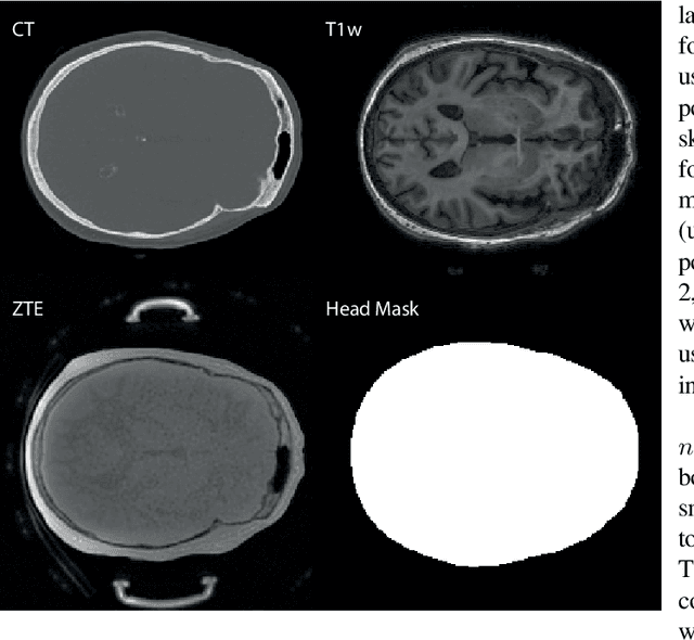 Figure 1 for Classical and learned MR to pseudo-CT mappings for accurate transcranial ultrasound simulation