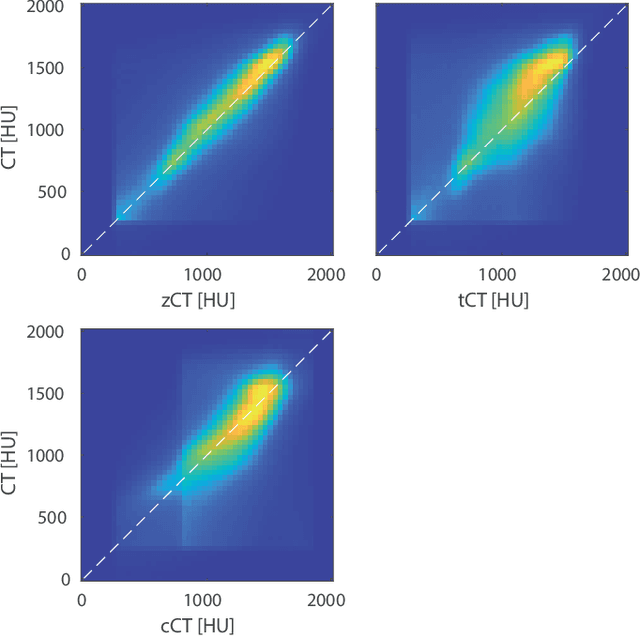 Figure 2 for Classical and learned MR to pseudo-CT mappings for accurate transcranial ultrasound simulation