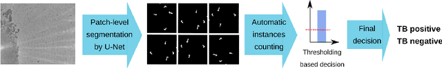 Figure 1 for Prediction of Tuberculosis using U-Net and segmentation techniques