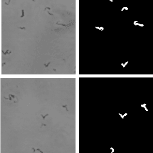 Figure 2 for Prediction of Tuberculosis using U-Net and segmentation techniques