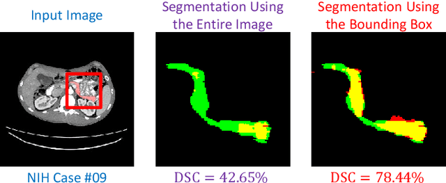 Figure 1 for A Fixed-Point Model for Pancreas Segmentation in Abdominal CT Scans