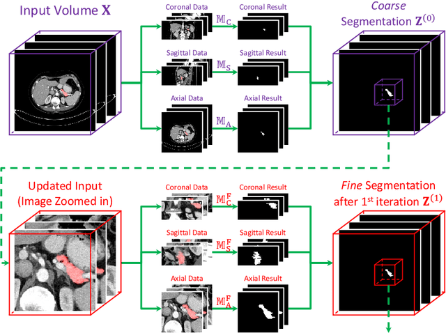 Figure 3 for A Fixed-Point Model for Pancreas Segmentation in Abdominal CT Scans