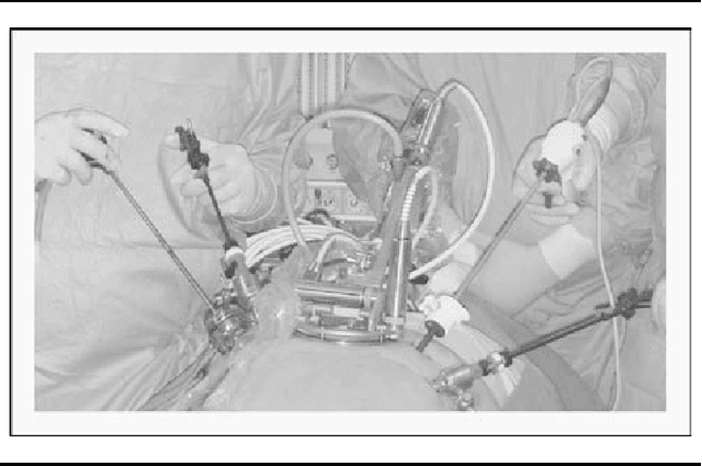 Figure 1 for Urologic robots and future directions