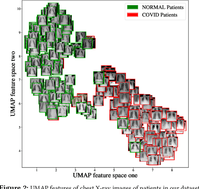 Figure 3 for COVID-19 detection using Residual Attention Network an Artificial Intelligence approach