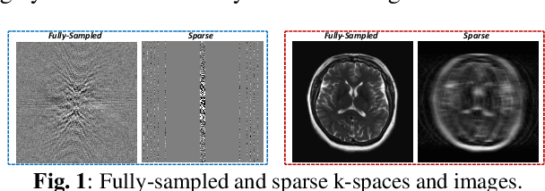 Figure 1 for Dual-Domain Cross-Iteration Squeeze-Excitation Network for Sparse Reconstruction of Brain MRI