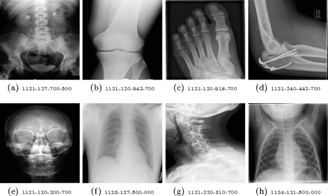 Figure 2 for Stacked Autoencoders for Medical Image Search