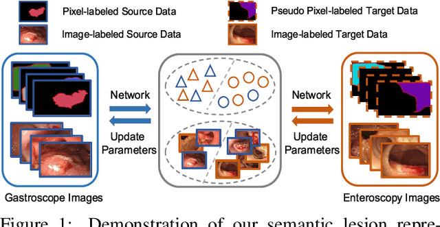 Figure 1 for Semantic-Transferable Weakly-Supervised Endoscopic Lesions Segmentation