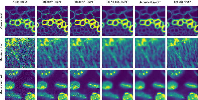 Figure 4 for Improving Blind Spot Denoising for Microscopy