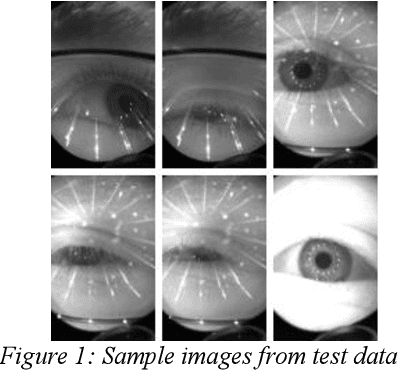 Figure 1 for Eyenet: Attention based Convolutional Encoder-Decoder Network for Eye Region Segmentation