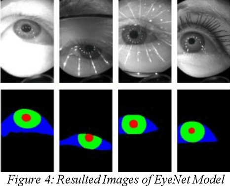 Figure 3 for Eyenet: Attention based Convolutional Encoder-Decoder Network for Eye Region Segmentation