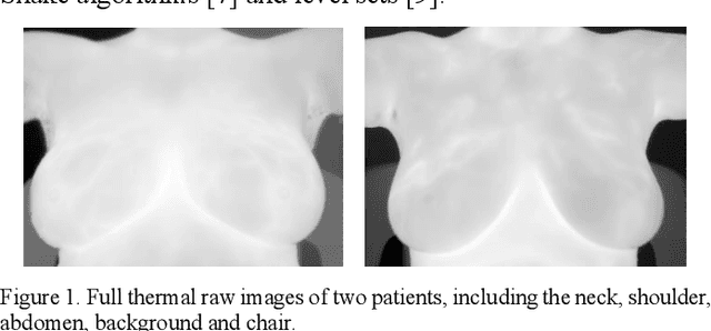 Figure 1 for Segmentation of Infrared Breast Images Using MultiResUnet Neural Network