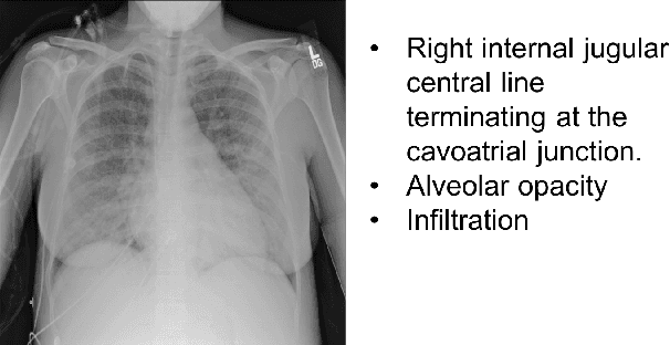 Figure 1 for Building a Benchmark Dataset and Classifiers for Sentence-Level Findings in AP Chest X-rays