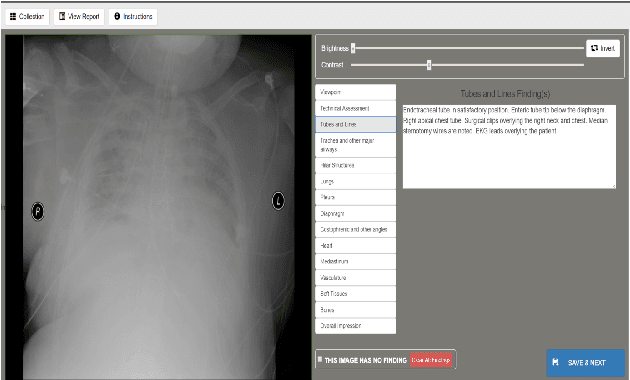 Figure 4 for Building a Benchmark Dataset and Classifiers for Sentence-Level Findings in AP Chest X-rays