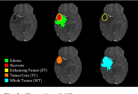 Figure 3 for Multi-modal Brain Tumor Segmentation via Missing Modality Synthesis and Modality-level Attention Fusion