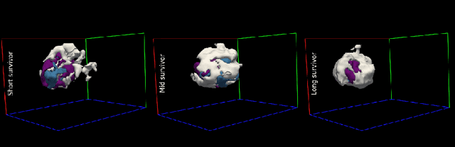 Figure 4 for Semi-Supervised Variational Autoencoder for Survival Prediction