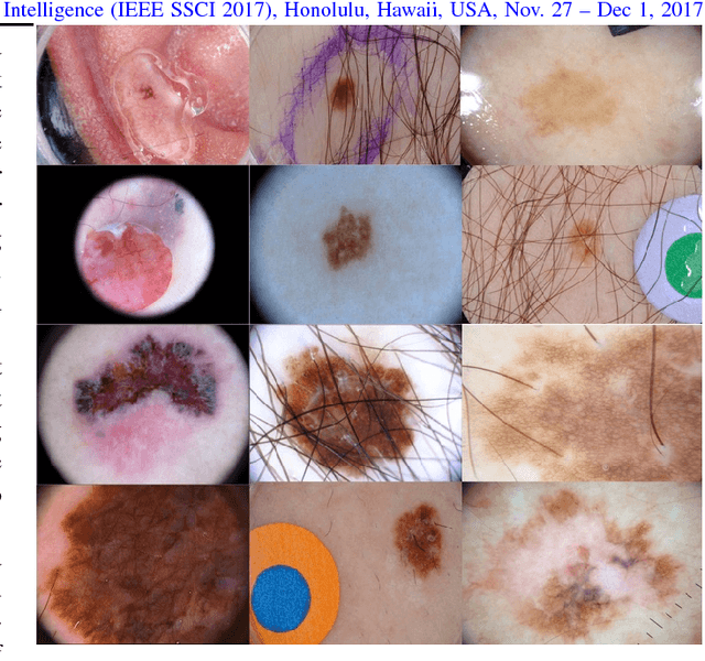 Figure 1 for Skin Lesion Segmentation: U-Nets versus Clustering
