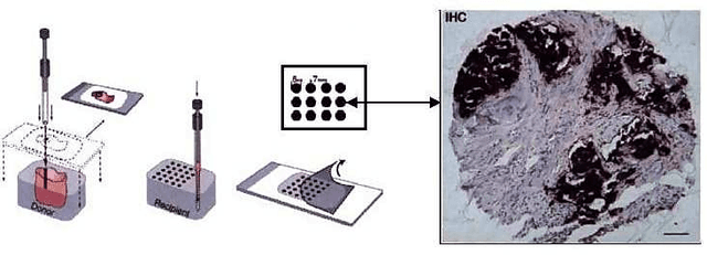 Figure 1 for Learning Low-dimensional Manifolds for Scoring of Tissue Microarray Images