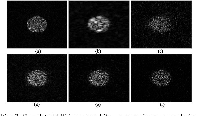 Figure 2 for Compressive Deconvolution in Medical Ultrasound Imaging