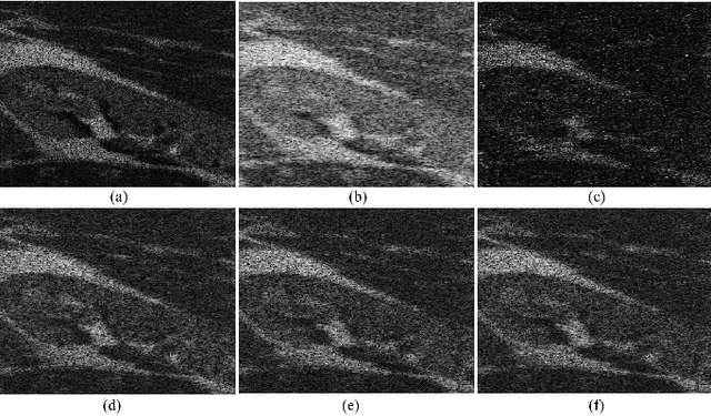 Figure 3 for Compressive Deconvolution in Medical Ultrasound Imaging