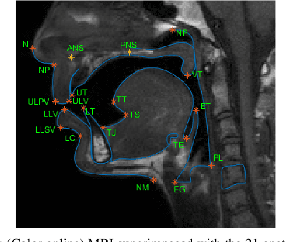 Figure 1 for Automatic vocal tract landmark localization from midsagittal MRI data