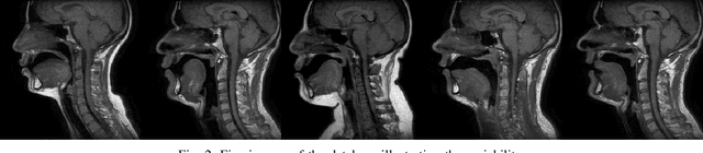 Figure 4 for Automatic vocal tract landmark localization from midsagittal MRI data