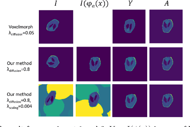 Figure 4 for Towards segmentation and spatial alignment of the human embryonic brain using deep learning for atlas-based registration