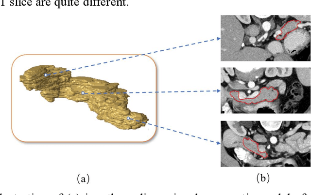 Figure 1 for Pancreas Segmentation via Spatial Context based U-net and Bidirectional LSTM