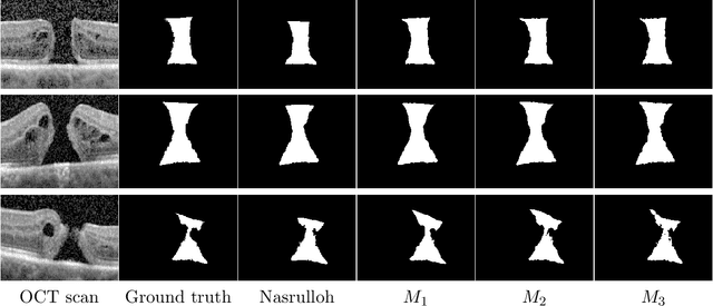 Figure 3 for Robust 3D U-Net Segmentation of Macular Holes