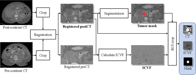 Figure 1 for Spatial-Temporal Convolutional LSTMs for Tumor Growth Prediction by Learning 4D Longitudinal Patient Data