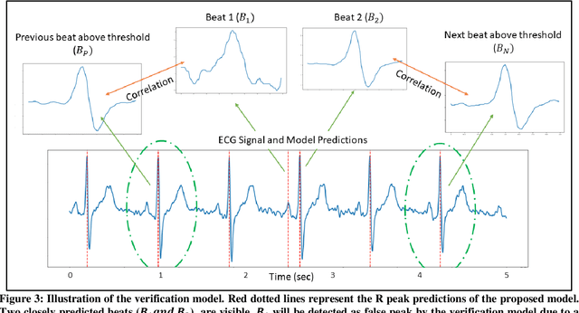 Figure 3 for Robust R-Peak Detection in Low-Quality Holter ECGs using 1D Convolutional Neural Network
