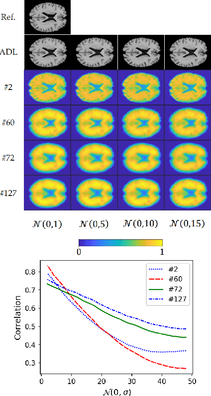 Figure 2 for Adversarial Distortion Learning for Medical Image Denoising